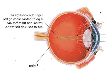 Lasik leikkaus likinäköisyys. jälkeen andndash; sairaalassa. Lasik leikkaus likinäköisyys. jälkeen andndash; sairaalassa.