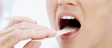Kysy lääkäri: kurkkukipu Kysy lääkäri: kurkkukipu