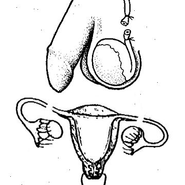 Sterilointi. jälkeen andndash; sairaalassa. Sterilointi. jälkeen andndash; sairaalassa.