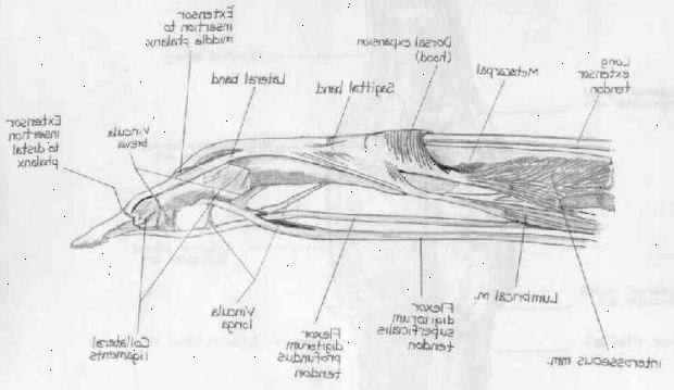 Jänne korjaus - extensor. jälkeen andndash; sairaalassa. Jänne korjaus - extensor. jälkeen andndash; sairaalassa.