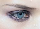 Epilepsia