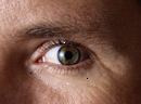 Diabeettisen retinopatian