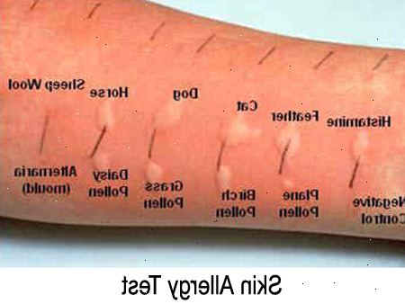 Allergiatestejä. RAST testi. Allergiatestejä. RAST testi.