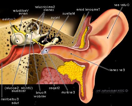 Tinnitus. mikä aiheuttaa tinnitus? Tinnitus. mikä aiheuttaa tinnitus?