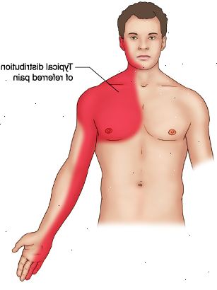 Angina pectoris (rintakipu). onko muita syitä? Angina pectoris (rintakipu). onko muita syitä?