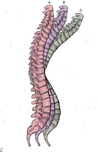 Osteoporoosi: estää kaatumisia. miksi kaatumisten kotona? Osteoporoosi: estää kaatumisia. miksi kaatumisten kotona?