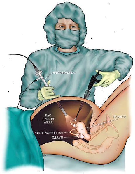 Laparoscopy. miten laparoscopy suoritetaan? Laparoscopy. miten laparoscopy suoritetaan?