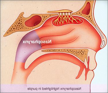 Syöpä nasopharynx. Mikä on syöpä nasopharynx? Syöpä nasopharynx. Mikä on syöpä nasopharynx?
