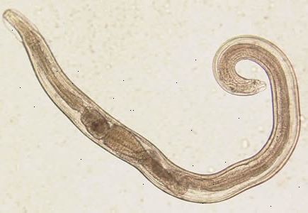 Threadworm (pinworm). Miten tartunnan levitä? Threadworm (pinworm). Miten tartunnan levitä?