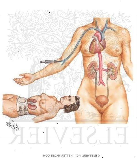 Urography (pyelography). muut ihmiset myös lukea. Urography (pyelography). muut ihmiset myös lukea.